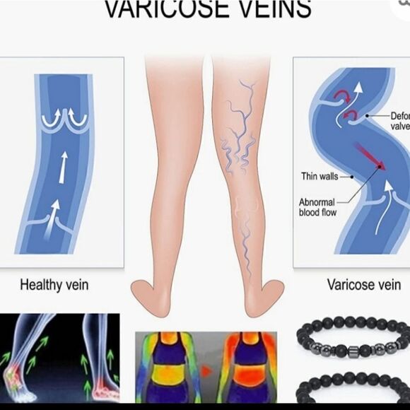 Anti swelling black obsidian stretch stone bracelet. - Picture 5 of 8